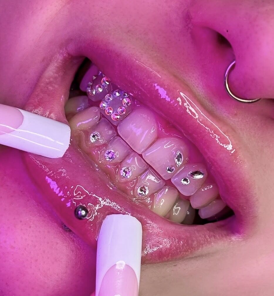 Zakładanie Biżuterii Nazębnej TOOTH GEMS