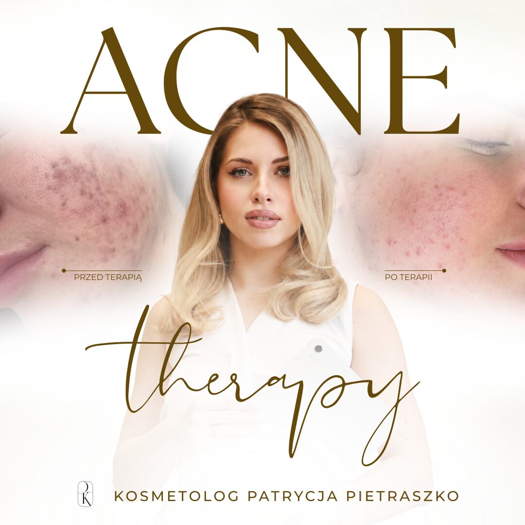 Acne Therapy (szkolenie indywidualne)