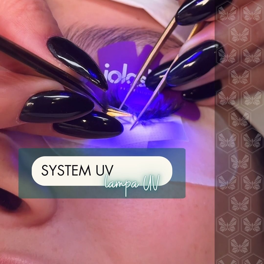 Metoda UV
