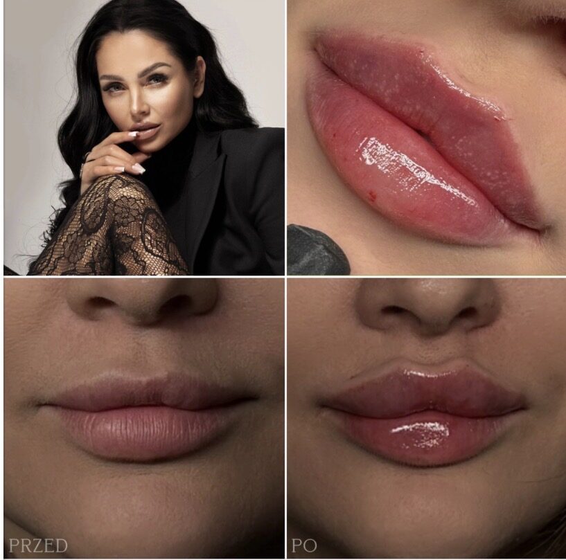 Perfect balance Lips