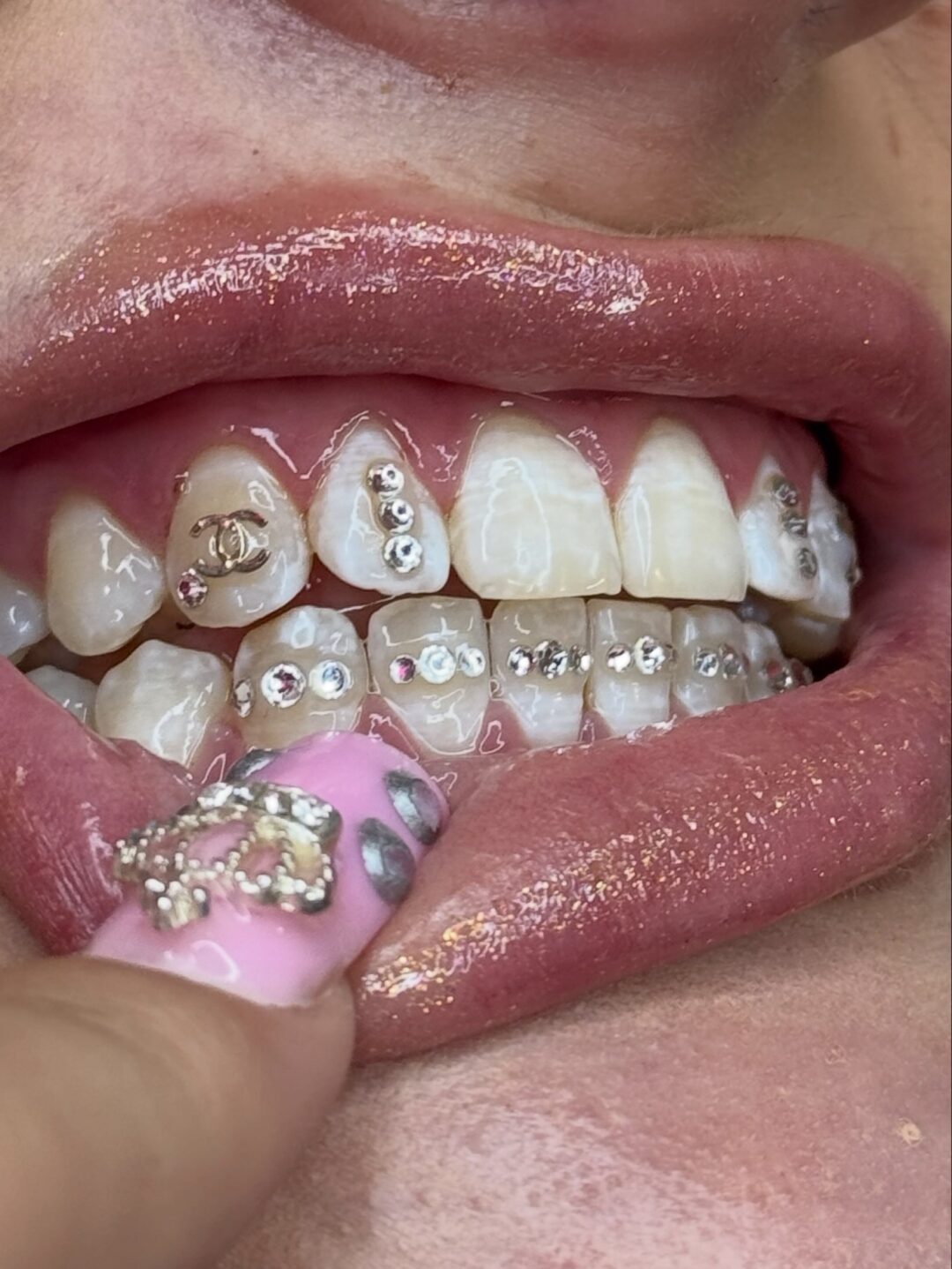 TOOTH GEMS