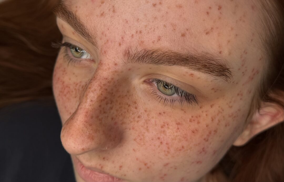 Holy Freckles - piegi permanentne
